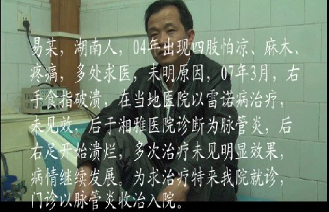 中医治疗脉管炎