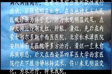 脉管炎治疗图片