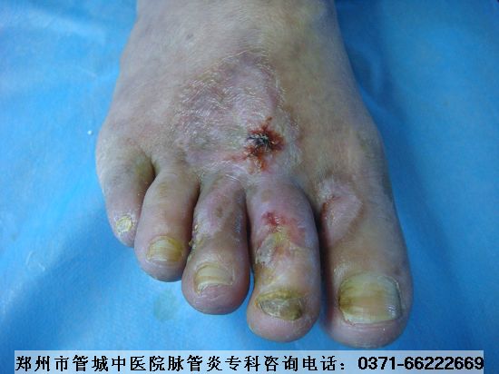 Âö¹ÜÑ׿µ¸´ÖÎÁÆ