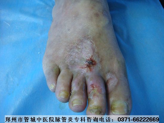 ÖÐÒ½ÖÎÁÆÂö¹ÜÑ×µÄÒ½Ôº